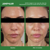 ADIPEAU - VOLUME CREAM