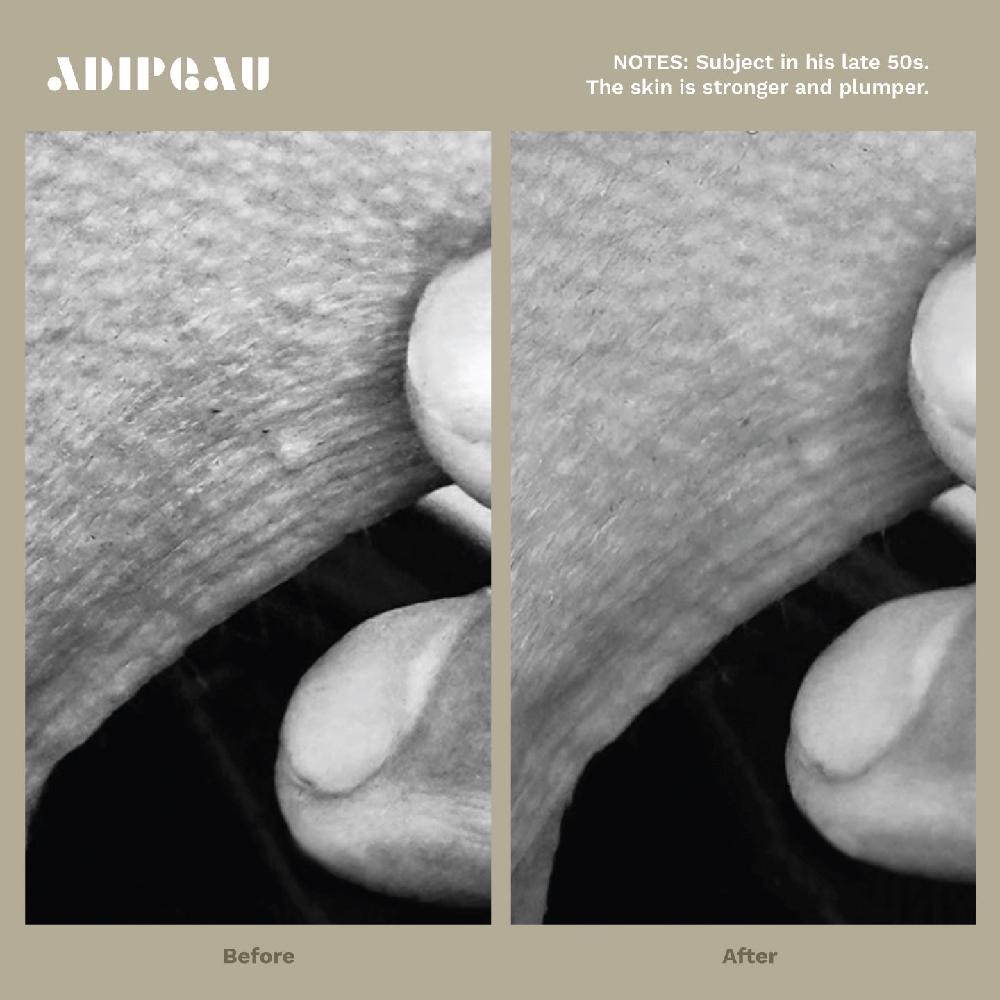 ADIPEAU - STRONG BODY GEL