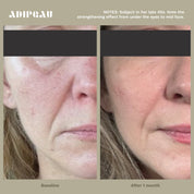 ADIPEAU - STRONG BODY GEL