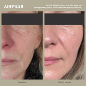 ADIPEAU - STRONG BODY GEL