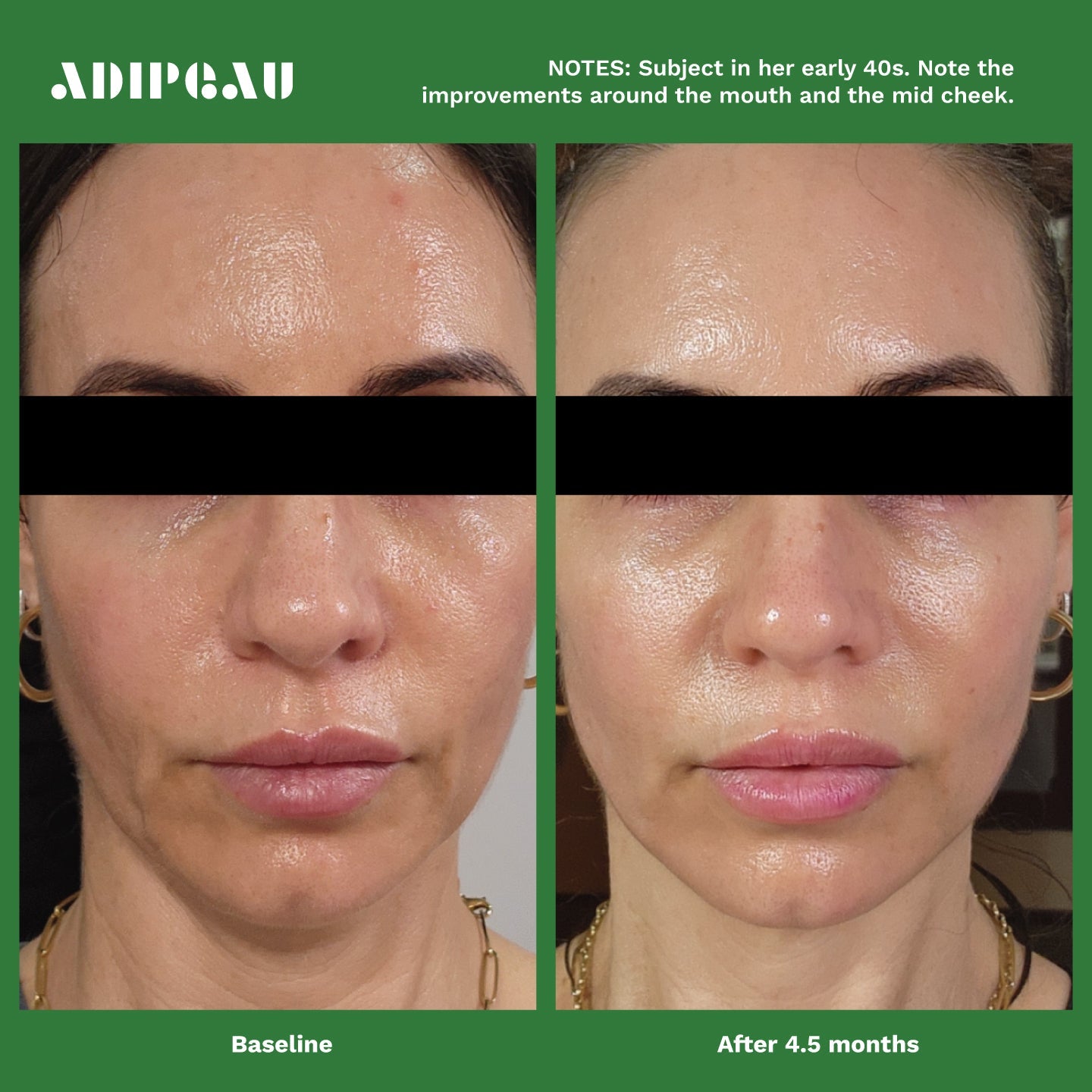 ADIPEAU - VOLUME CREAM