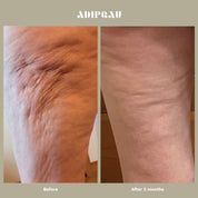 ADIPEAU - STRONG BODY GEL